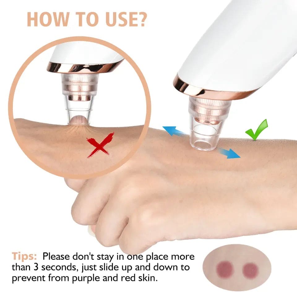 Electric Blackhead Remover, Vacuum Acne Cleaner, Black Spots Removal Device, Pore Cleaner Machine