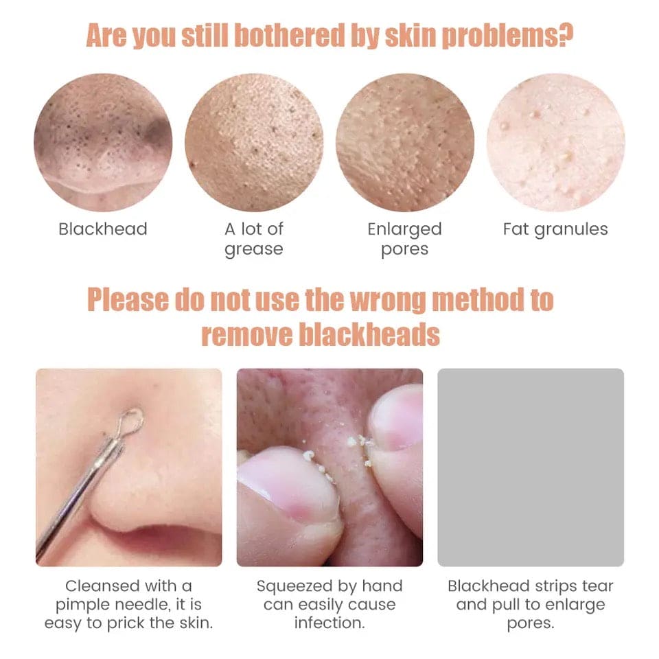 Electric Blackhead Remover, Vacuum Acne Cleaner, Black Spots Removal Device, Pore Cleaner Machine